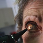 cataract surgery treatment prevention